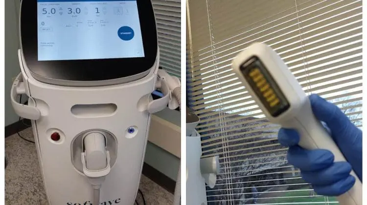 Sofwave Device non invasive skin procedures