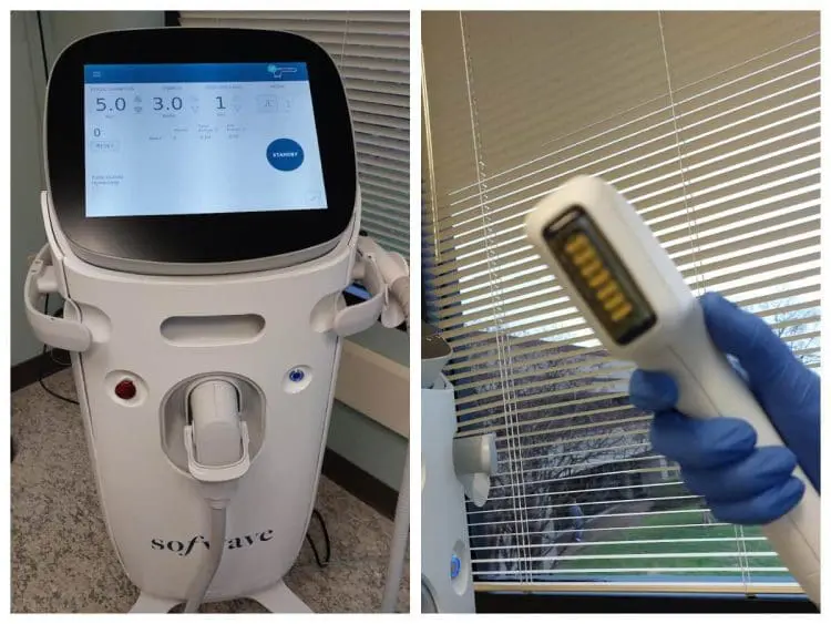 Sofwave device and wand