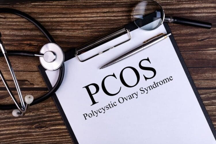 how to manage PCOS naturally